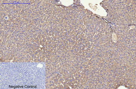 Cytokeratin 8 Ab