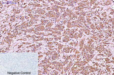 Cytokeratin 6A Ab