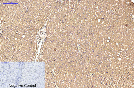 Transferrin Ab