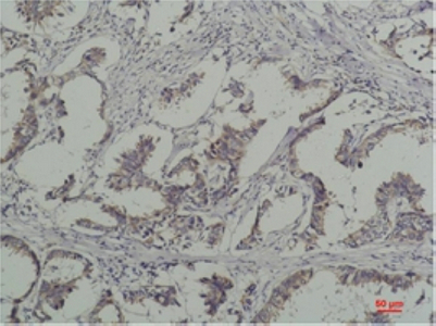 p-Tyrosine Ab