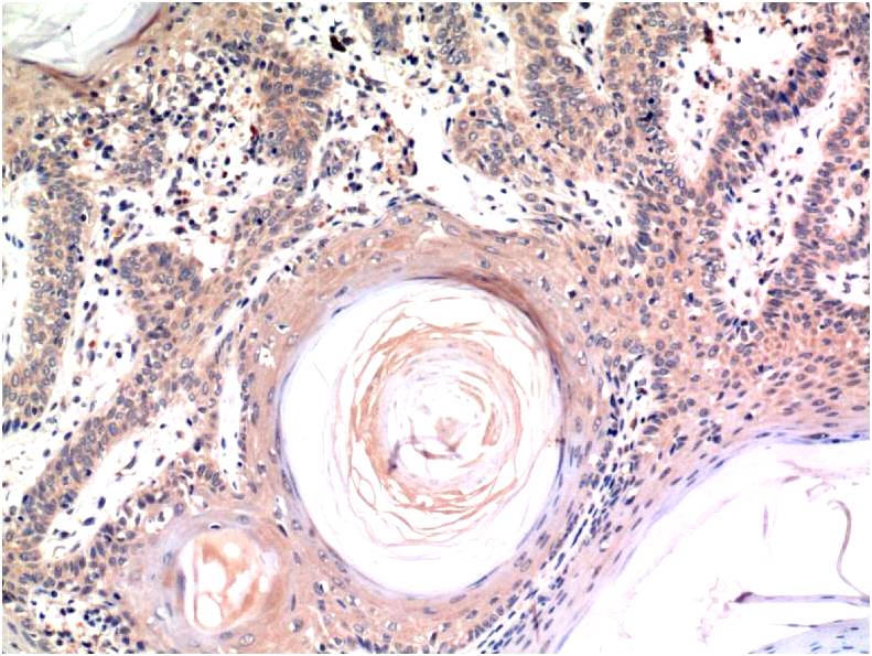 Caspase 3 Ab