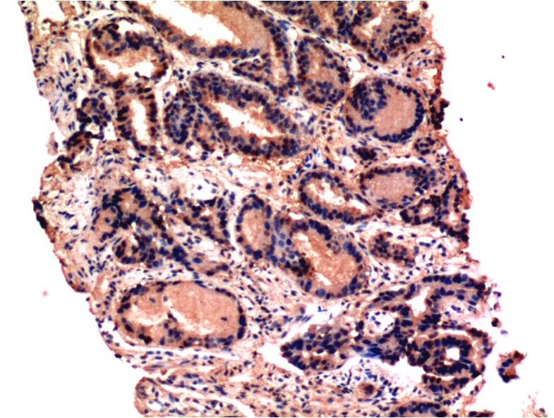 Caspase 3 Ab