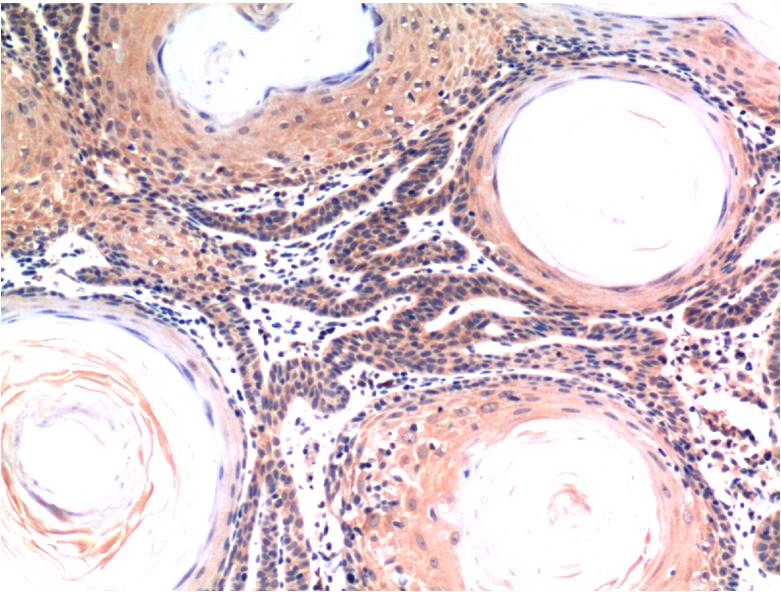 Caspase 3 Ab