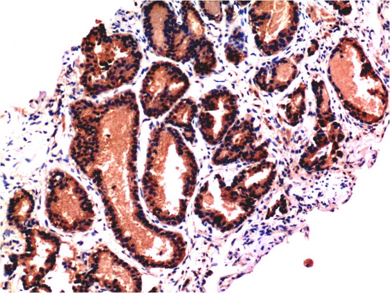 Caspase 3 Ab