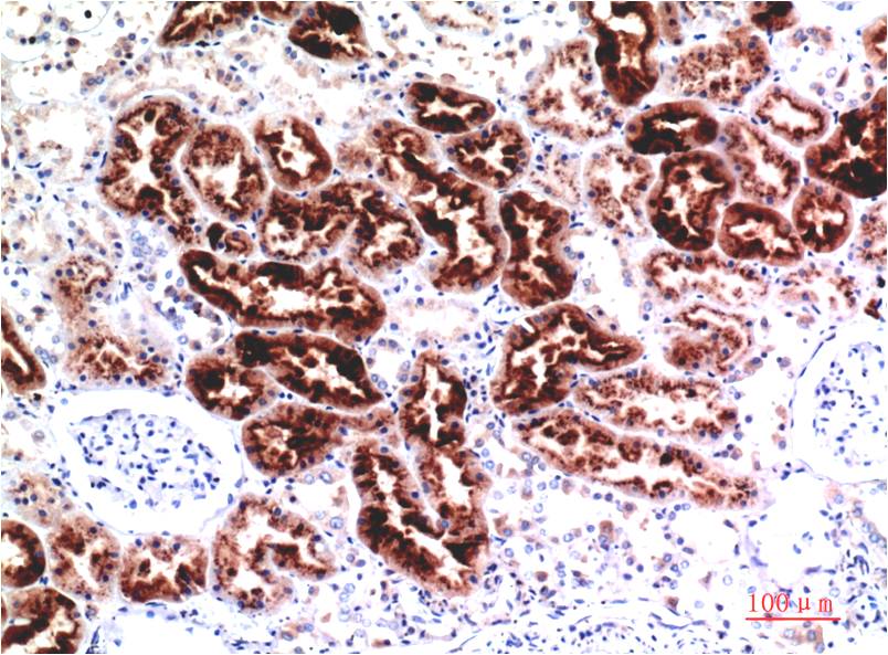 Cystatin C Ab