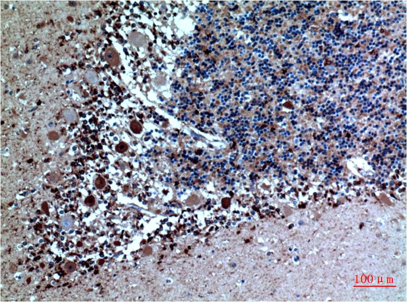 Cystatin C Ab