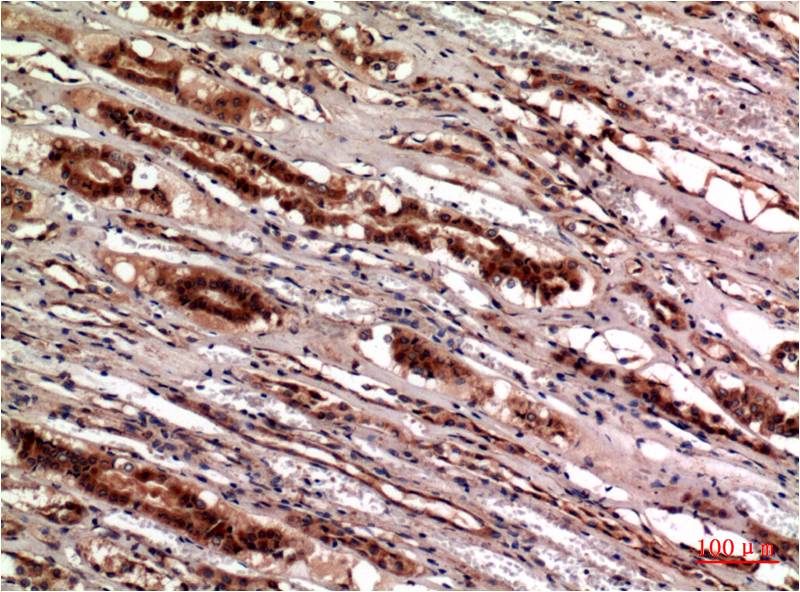 Cystatin C Ab