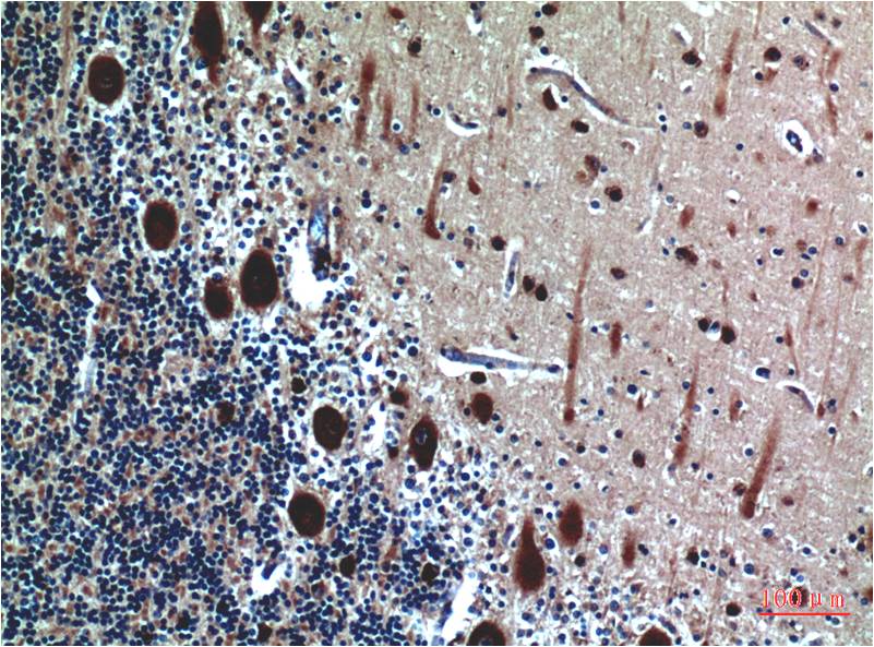 Cystatin C Ab