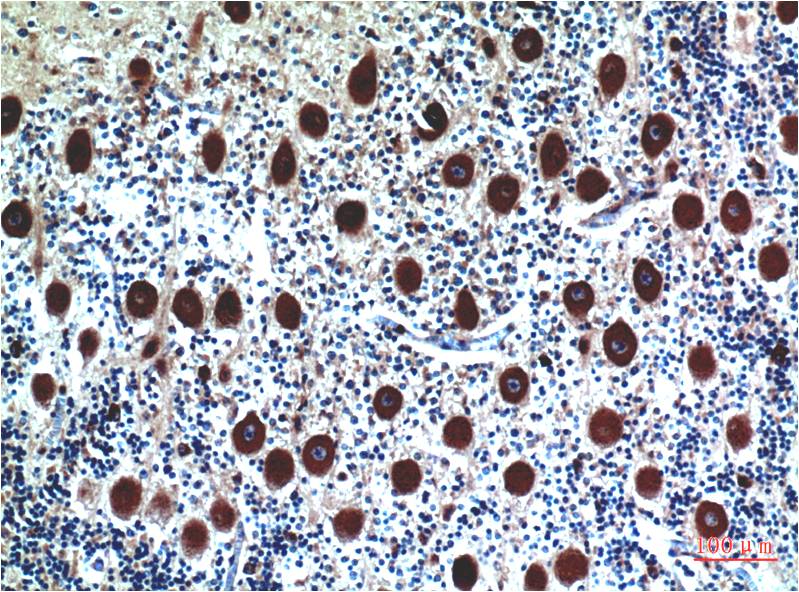 Cystatin C Ab