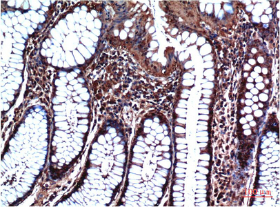 GSK 3 beta Ab