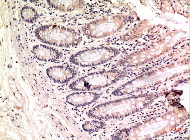 gamma 1 Tubulin Ab