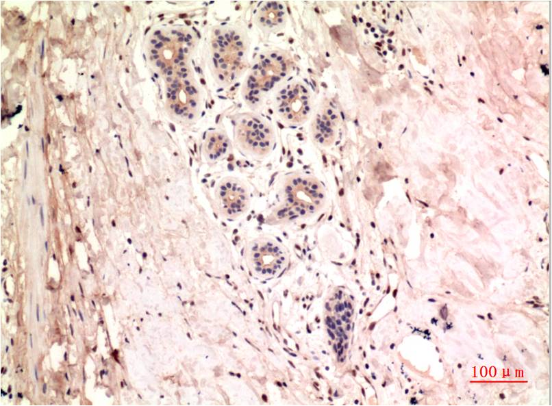 gamma 1 Tubulin Ab