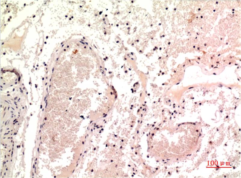 gamma 1 Tubulin Ab