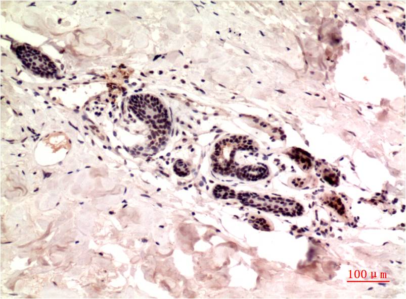 gamma 1 Tubulin Ab