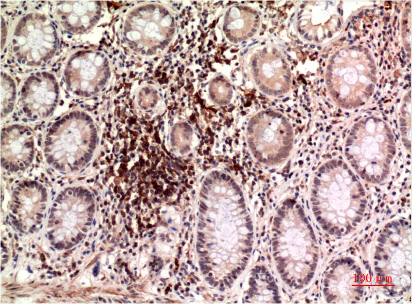 epsilon Tubulin Ab