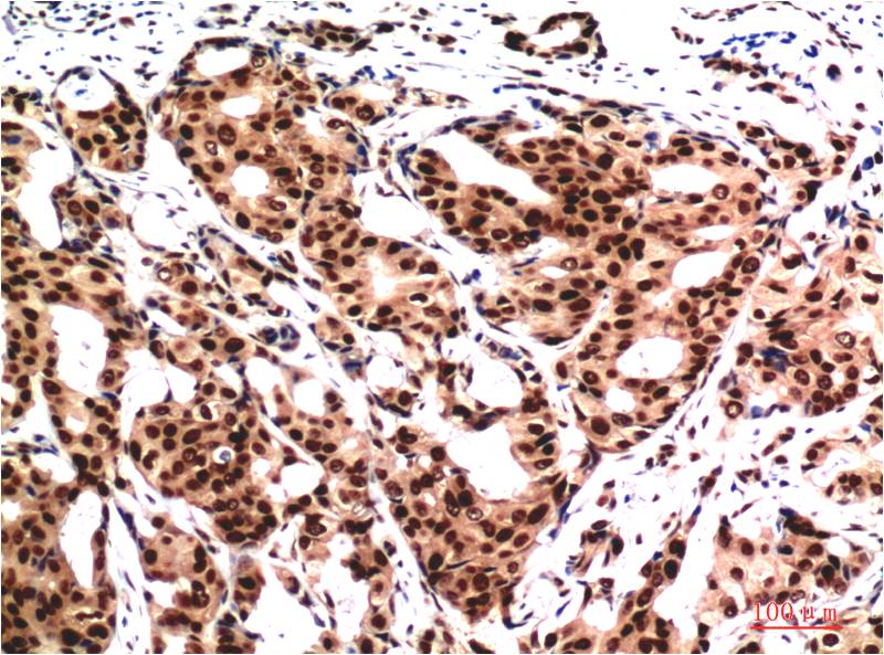 Ubiquitin Ab