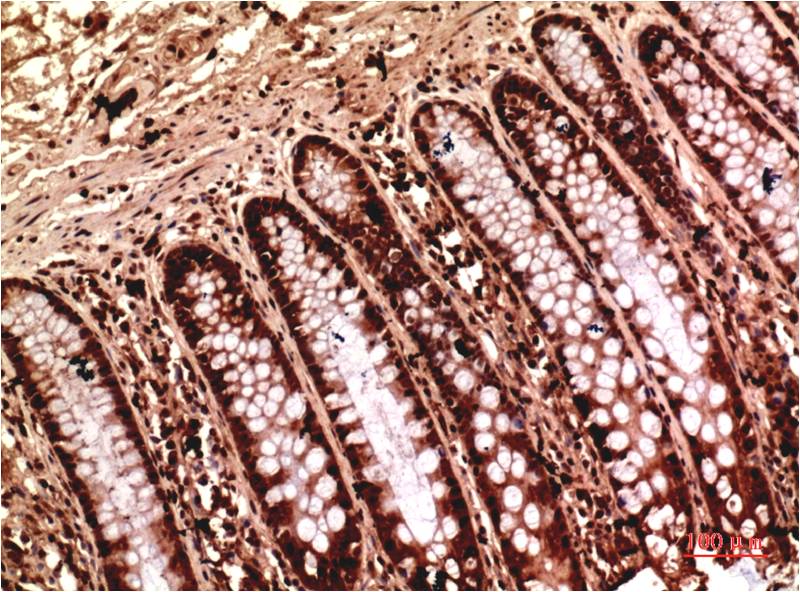 gamma 1 Tubulin Ab