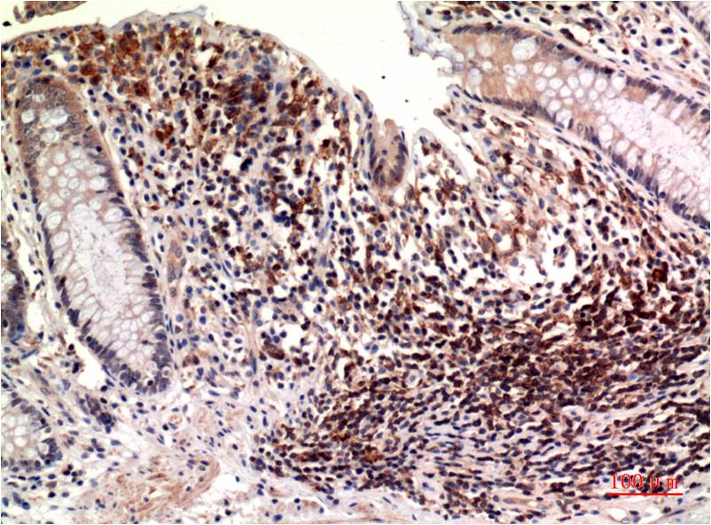 epsilon Tubulin Ab