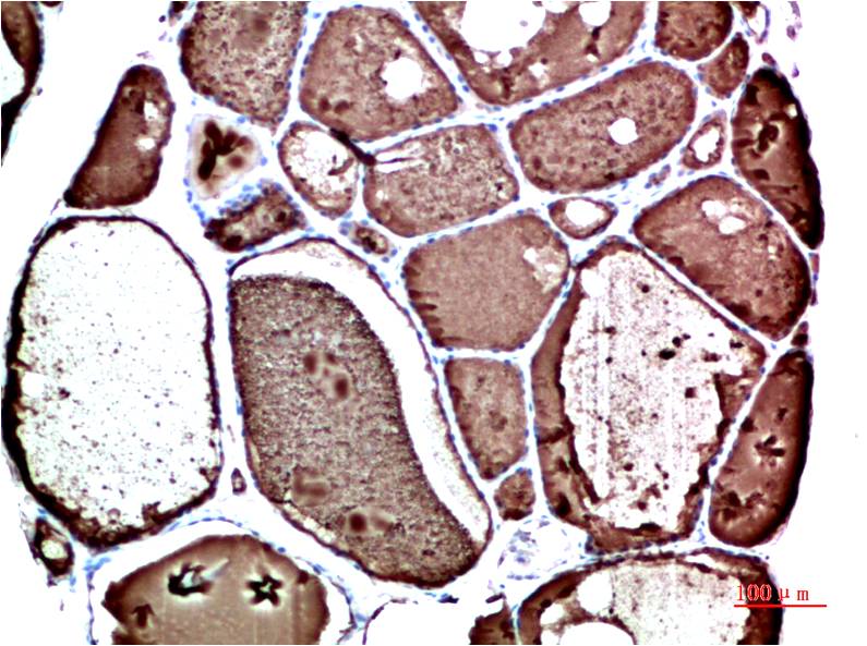 Transthyretin Ab