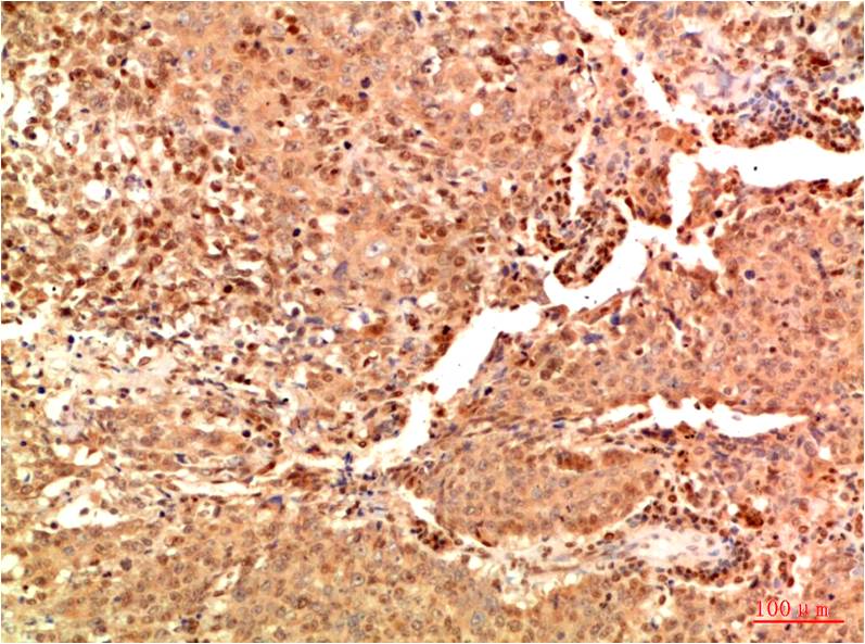 Acetyl-NF-kB p65 (K314/K315) Ab