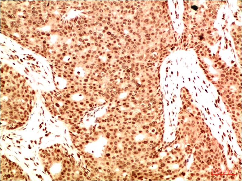 Acetyl-NF-kB p65 (K314/K315) Ab