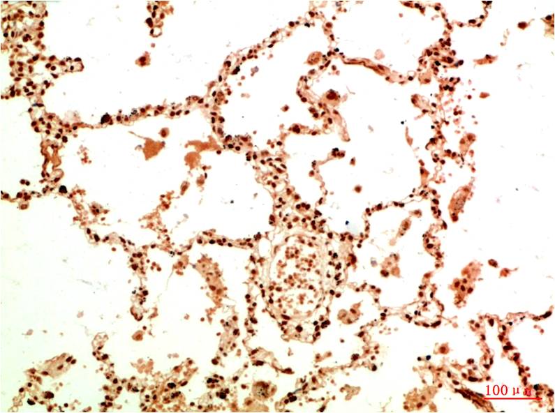 Acetyl-NF-kB p65 (K314/K315) Ab