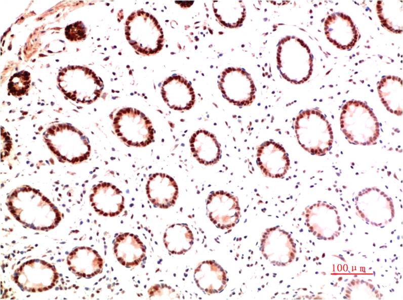 Collagen I alpha 1 Ab