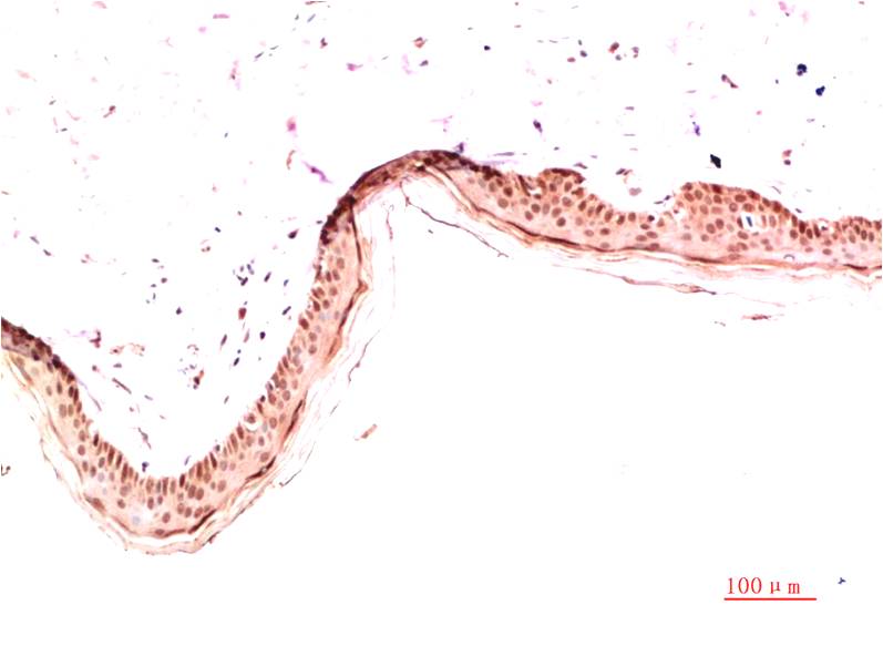 Collagen I alpha 1 Ab