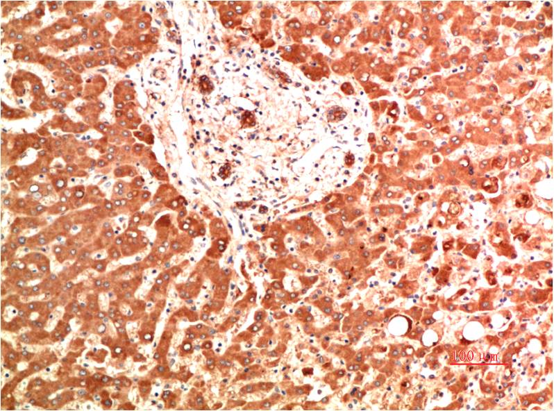 Collagen IV alpha 1 Ab