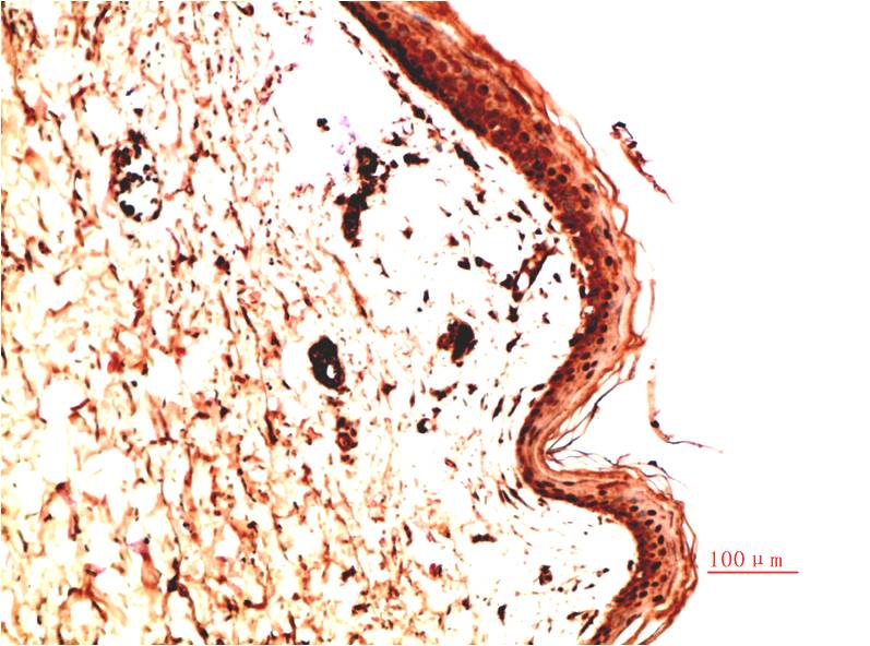 Collagen IV alpha 1 Ab