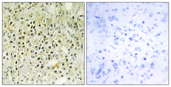 Galectin 8 Ab