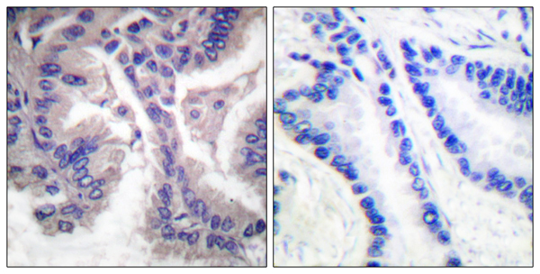 Cleaved-Caspase 6 p18 Ab