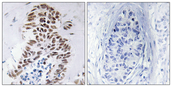 DAP kinase 3 Ab