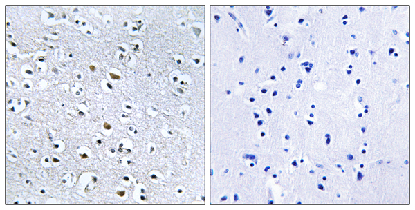 Nephrocystin 4 Ab