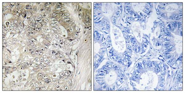 Cystatin SN Ab