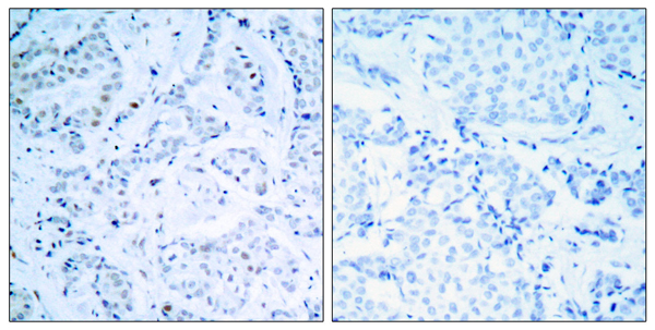 Estrogen receptor Ab