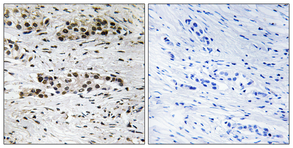 p-Estrogen receptor (S102) Ab