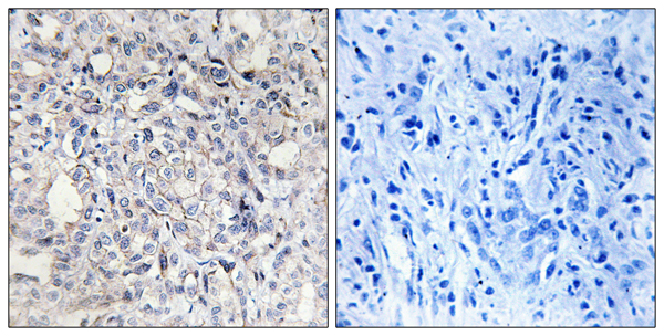 Heparin cofactor 2 Ab