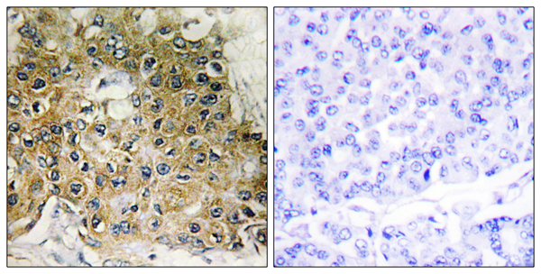 p-Integrin beta 1 (T789) Ab