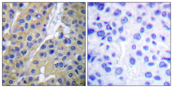 p-Cytokeratin 18 (S33) Ab