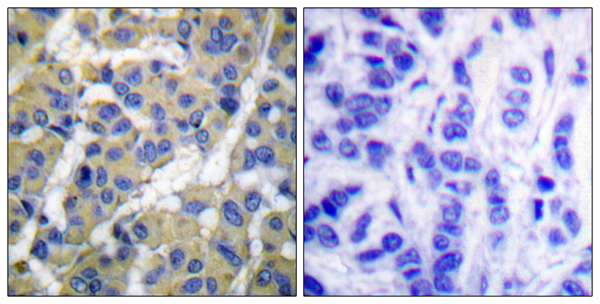 p-Cytokeratin 8 (S74) Ab