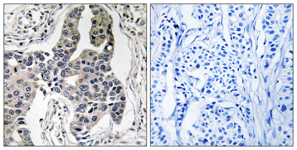 p-Vimentin (S83) Ab