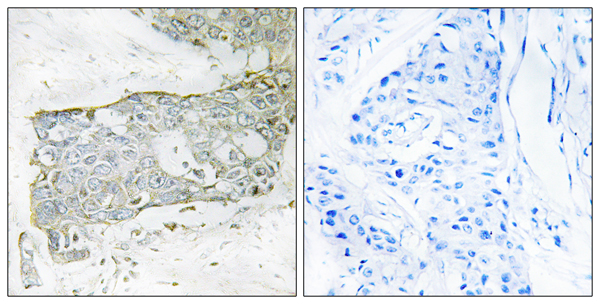 Coagulation factor VII light chain Ab