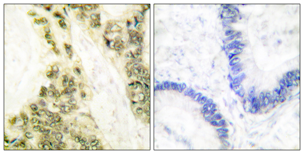 Thyroid hormone receptor alpha Ab