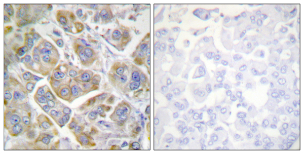 Integrin beta 4 Ab