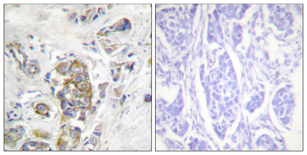 p-Integrin beta 4 (Y1510) Ab