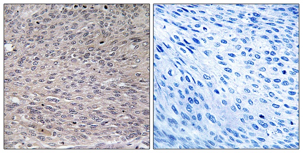 p-Aconitase 1 (S711) Ab