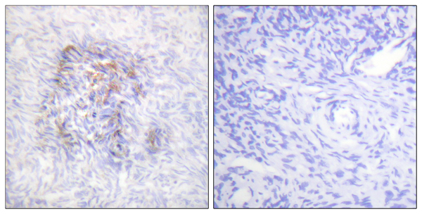 p-Aconitase 1 (S138) Ab