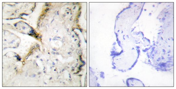 Laminin alpha 2 Ab