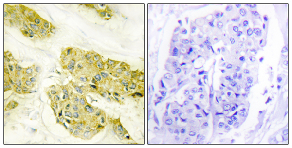 Collagen V alpha 3 Ab